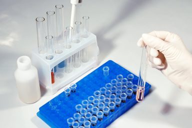 Lab technician scientist performs medical clinic chemical analysis and diagnostics using test tube phial and pipette.